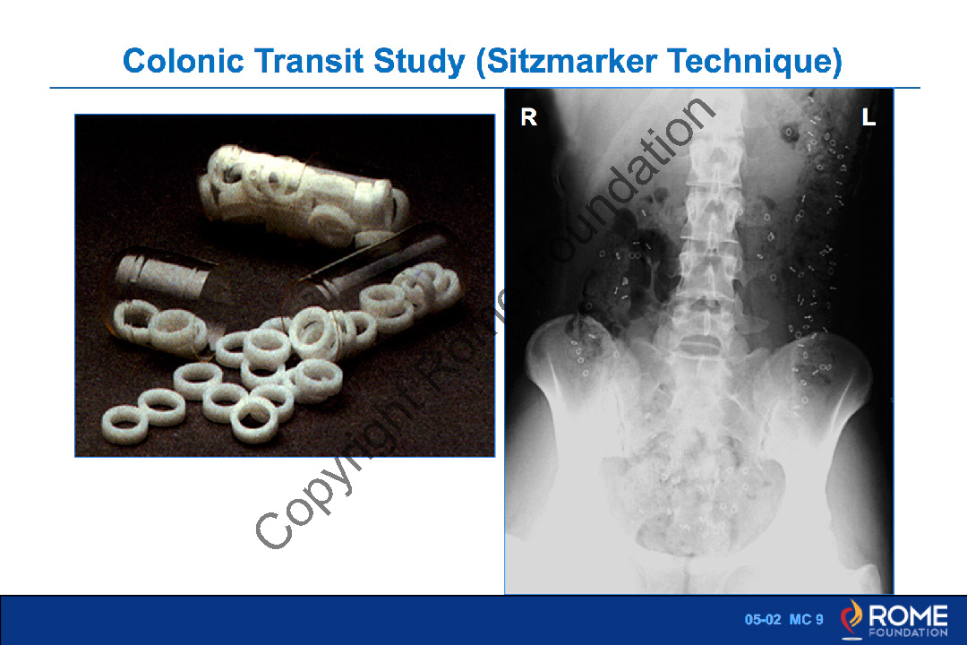 Pharmaco 02 – Colonic Transit Study – Rome Online