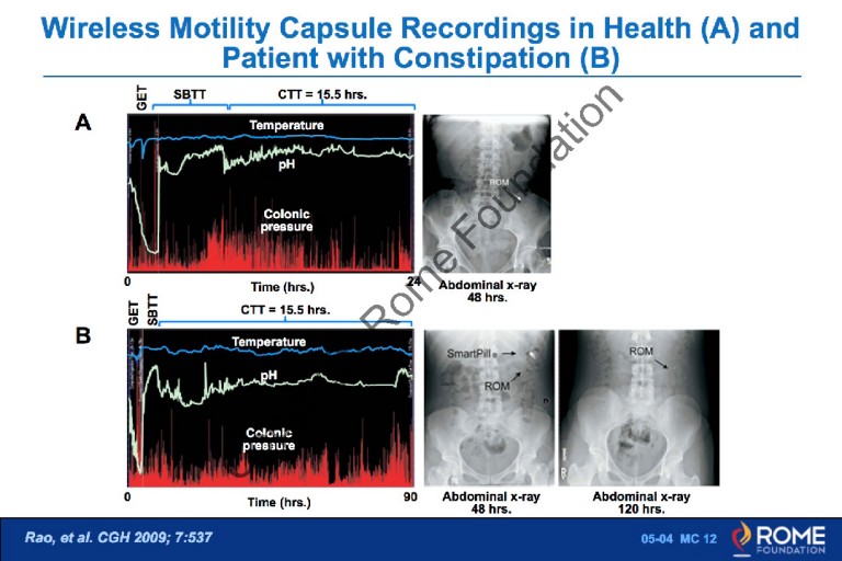 Pharmaco 02 – Colonic Transit Study – Rome Online