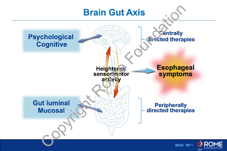Esophagus 02 Roles of Acid Exposure and Esophageal Hypersensitivity