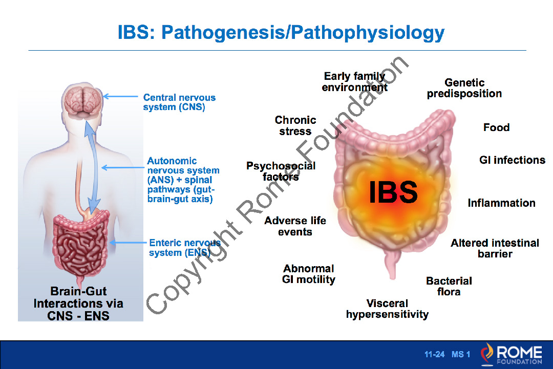 Ibs data. IBS. Акция IBS.