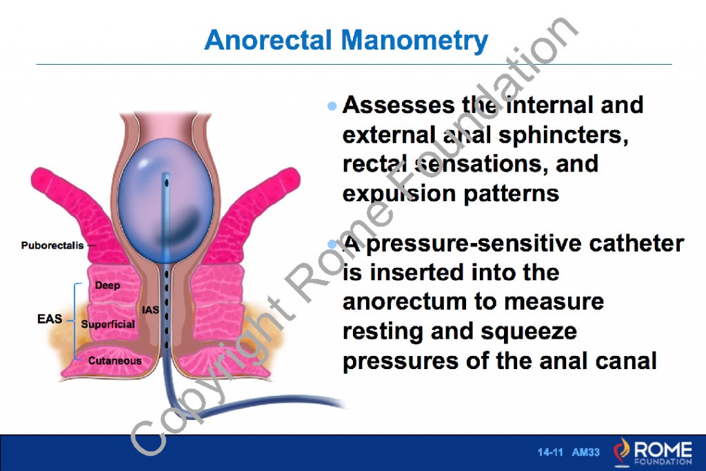 Anorectal 11 Anorectal Manometry Rome Online Anorectal 11 Anorectal Manometry Rome Online